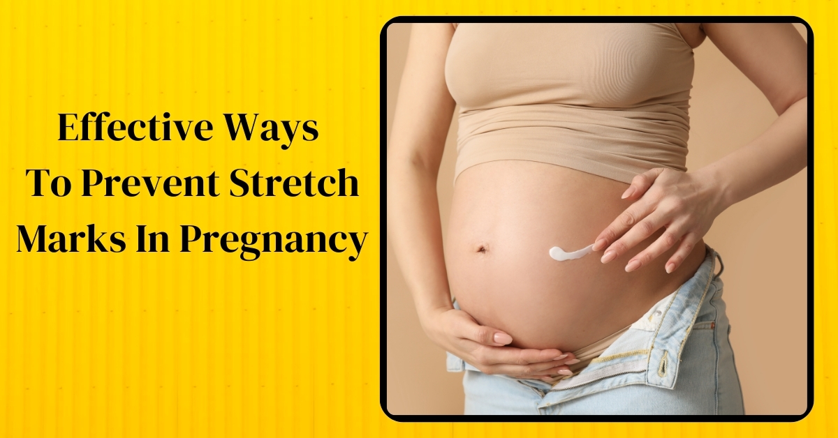 effective ways to prevent stretch marks in pregnancy